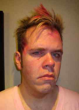 Canada Perez Hilton Punched